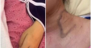 [UPDATED] Chinese student in private university stabbing case risks permanent disability, says lawyer