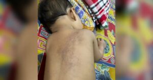 After NFA decision, mum mulls civil action over toddler’s injuries
