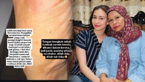 Bergadai nyawa besarkan awak – Ibu kecewa terima perintah injunksi Anna Jobling?