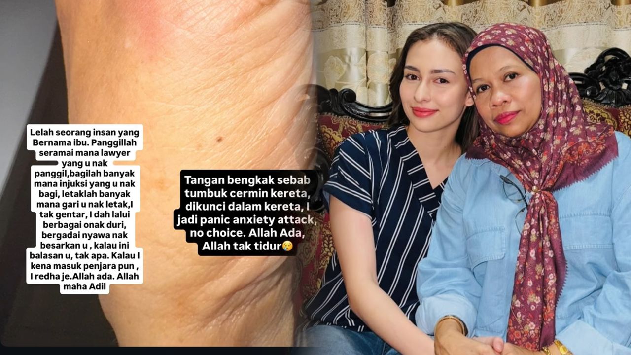 Bergadai nyawa besarkan awak – Ibu kecewa terima perintah injunksi Anna Jobling?