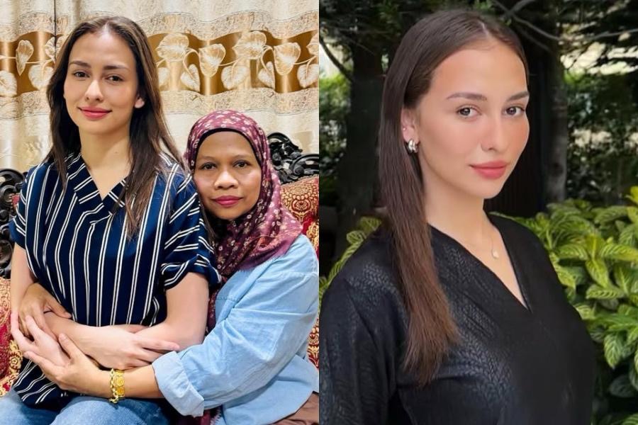 Bila sudah terkenal lupa diri, saya ini seperti anjing kurap - Ibu Anna Jobling