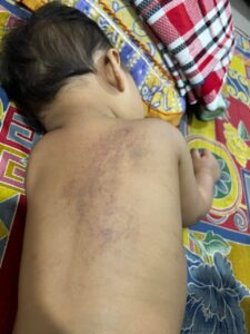 Wanita minta kes dakwaan anak didera disiasat semula