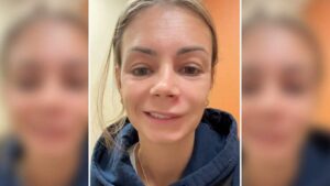 Wanita nyaris maut selepas picit jerawat pada wajah