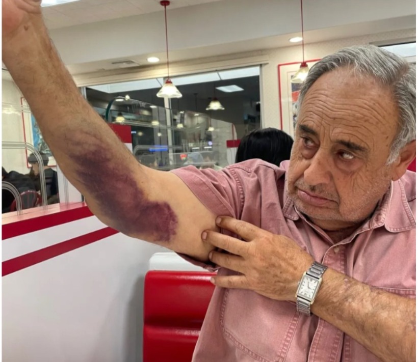 Dakwa dikasari dalam serbuan ICE, warga emas AS tuntut pampasan AS$50 juta