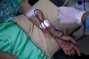 Government covers nearly full cost of dialysis for underprivileged patients