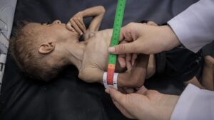 Kebuluran bakal wujudkan generasi cacat kekal di Gaza