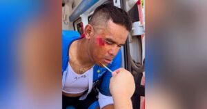 TSG sprinter Harrif suffers gruesome facial injury in China