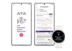 Samsung Bangunkan Pengesan Disfungsi Sistolik Ventrikel Kiri (LVSD) Pertama Untuk Jam Pintar