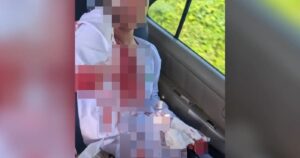 Sipitang schoolgirl injured while playing, not bullied, says school