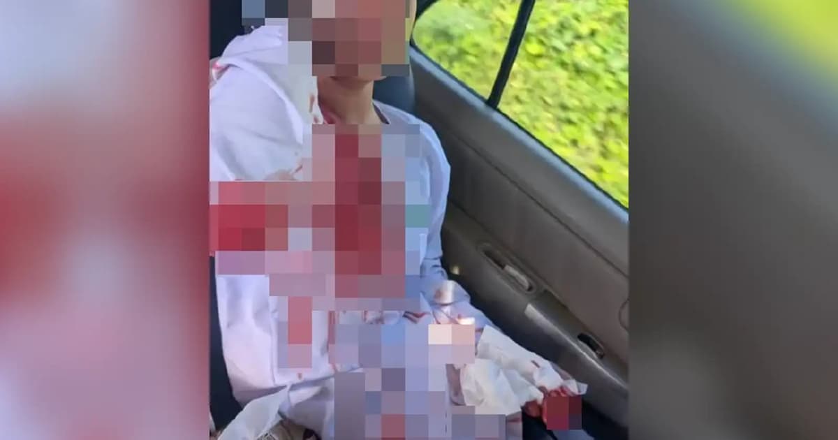 Sipitang schoolgirl injured while playing, not bullied, says school