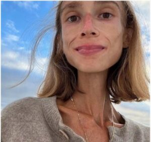 Wanita maut dalam bilik hotel akibat amal diet buah-buahan