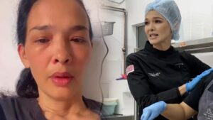 Zahnita umum tutup bakeri lepas lima bulan operasi