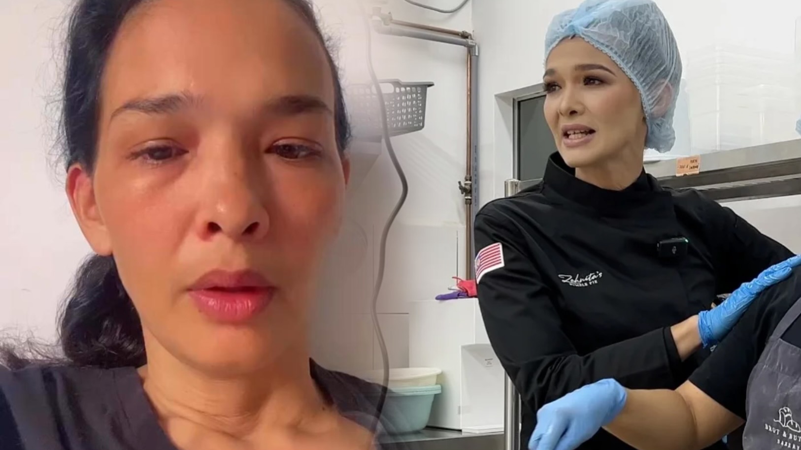 Zahnita umum tutup bakeri lepas lima bulan operasi