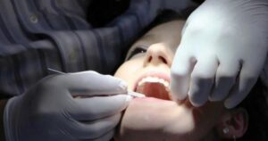 Countries agree to end mercury tooth fillings by 2034