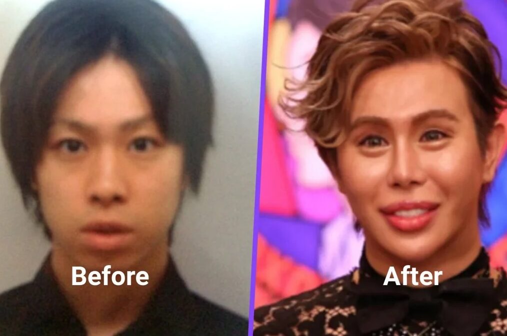 Mangsa buli belanja RM2.7 juta ubah wajah jadi ‘tercantik di dunia’