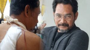 Masih tunggu keputusan ketumbuhan itu tumor atau kanser- Sahronizam Noor