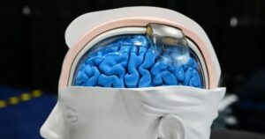 Neurotech  may be as revolutionary as much-hyped artificial intelligenceWe're already living in science fiction'