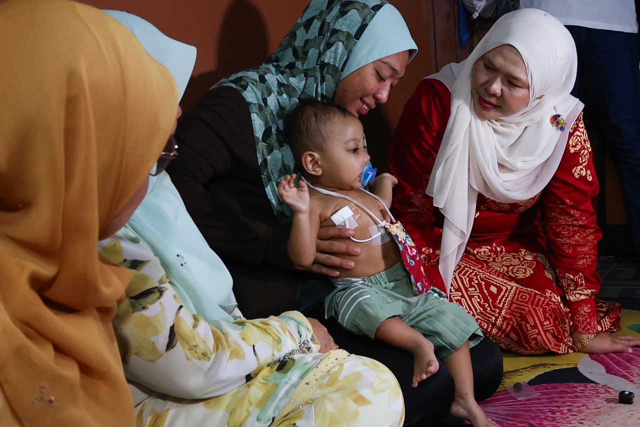 Kerajaan Perak bantu bayi 14 bulan hidap ketumbuhan