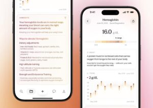 OpenAI Ambil-Alih Syarikat Fokus Teknologi Kesihatan, Torch
