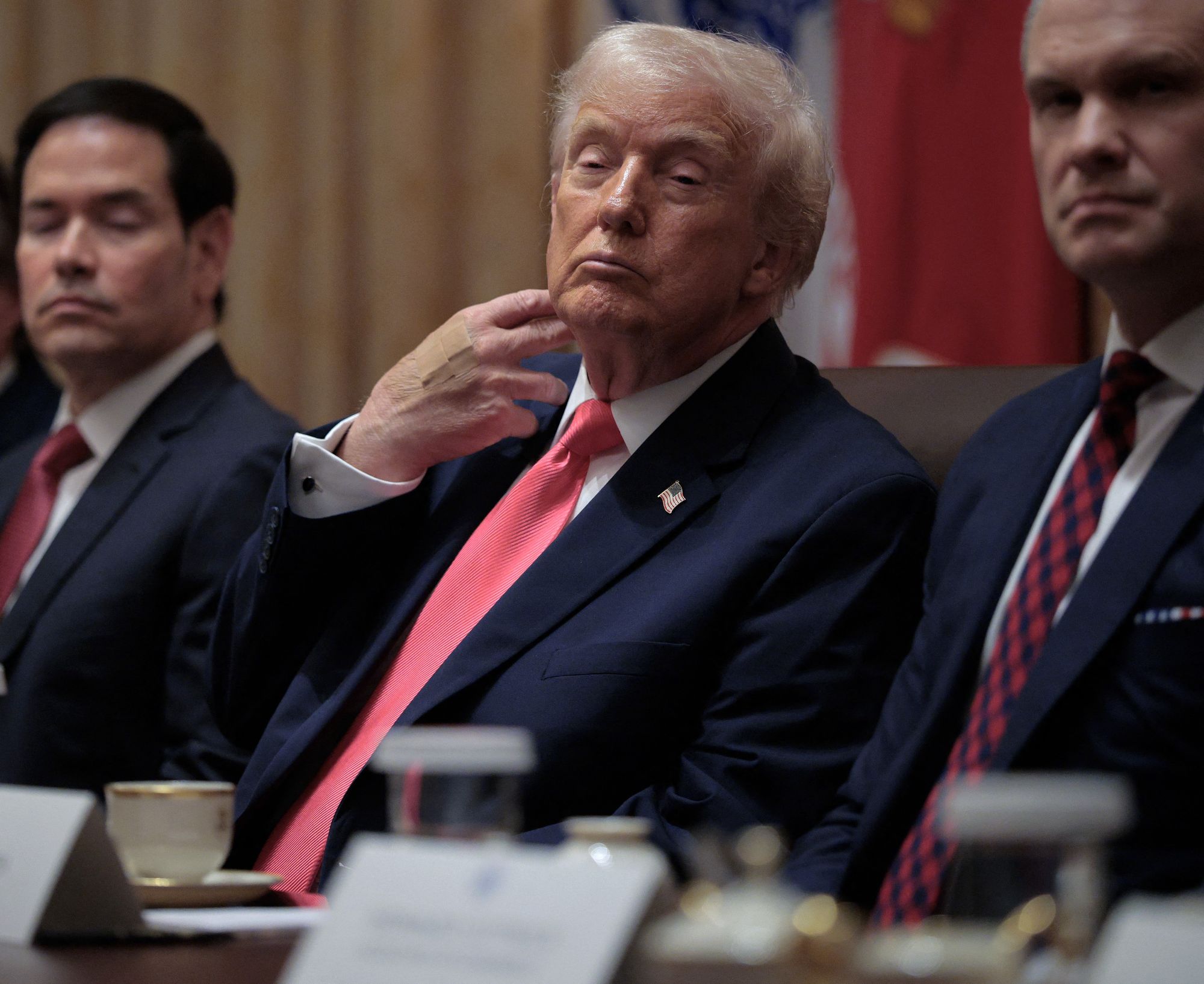 Trump dedah aspirin punca lebam di tangan, nafi tertidur dalam mesyuarat