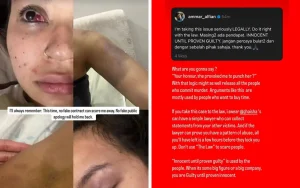 Cops to question actor over alleged assault of girlfriend