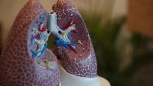 KKM Melancarkan Sistem Saringan Penyakit Paru-Paru Diperkasakan AI