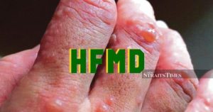 More than 4,000 HFMD cases in Sabah so far this year