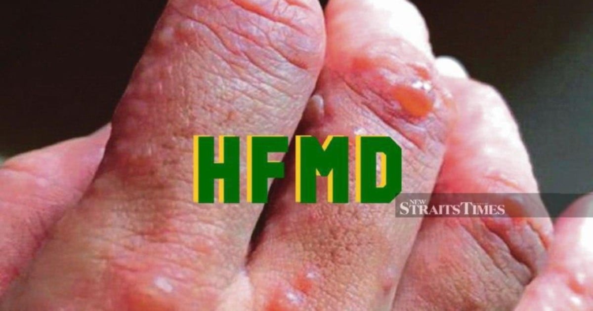 More than 4,000 HFMD cases in Sabah so far this year