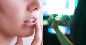 Wanita dakwa dijangkiti virus Herpes melalui mikrofon karaoke